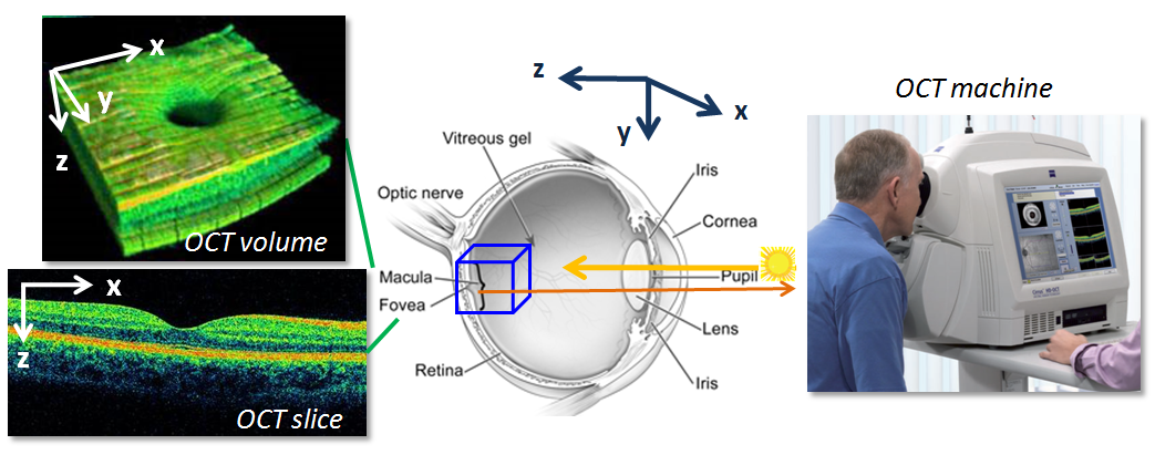 Optical Coherence Tomography