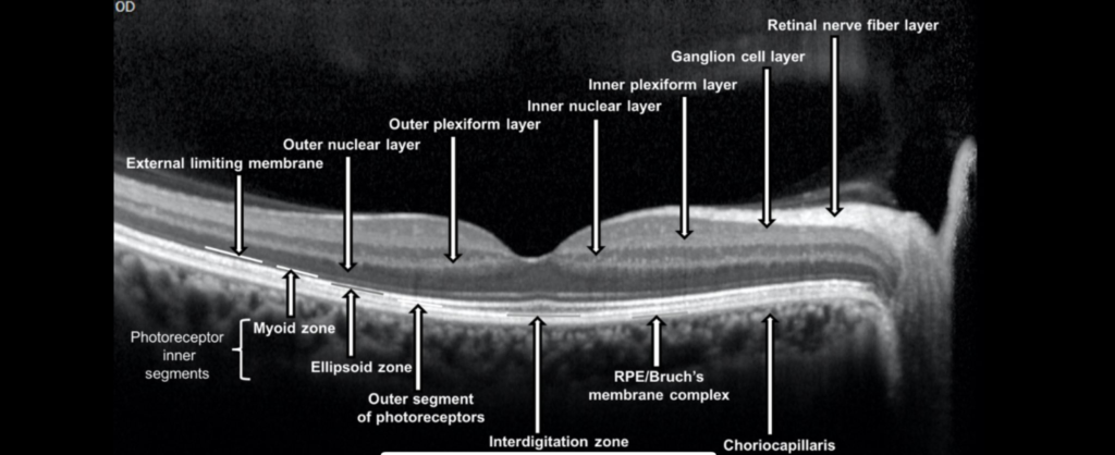 Optical Coherence Tomography