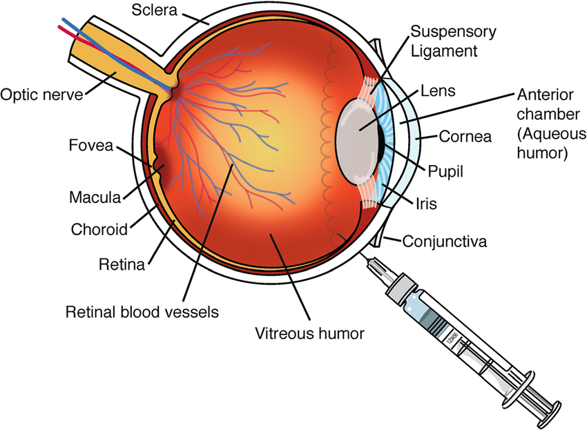 Intravitreal Injections