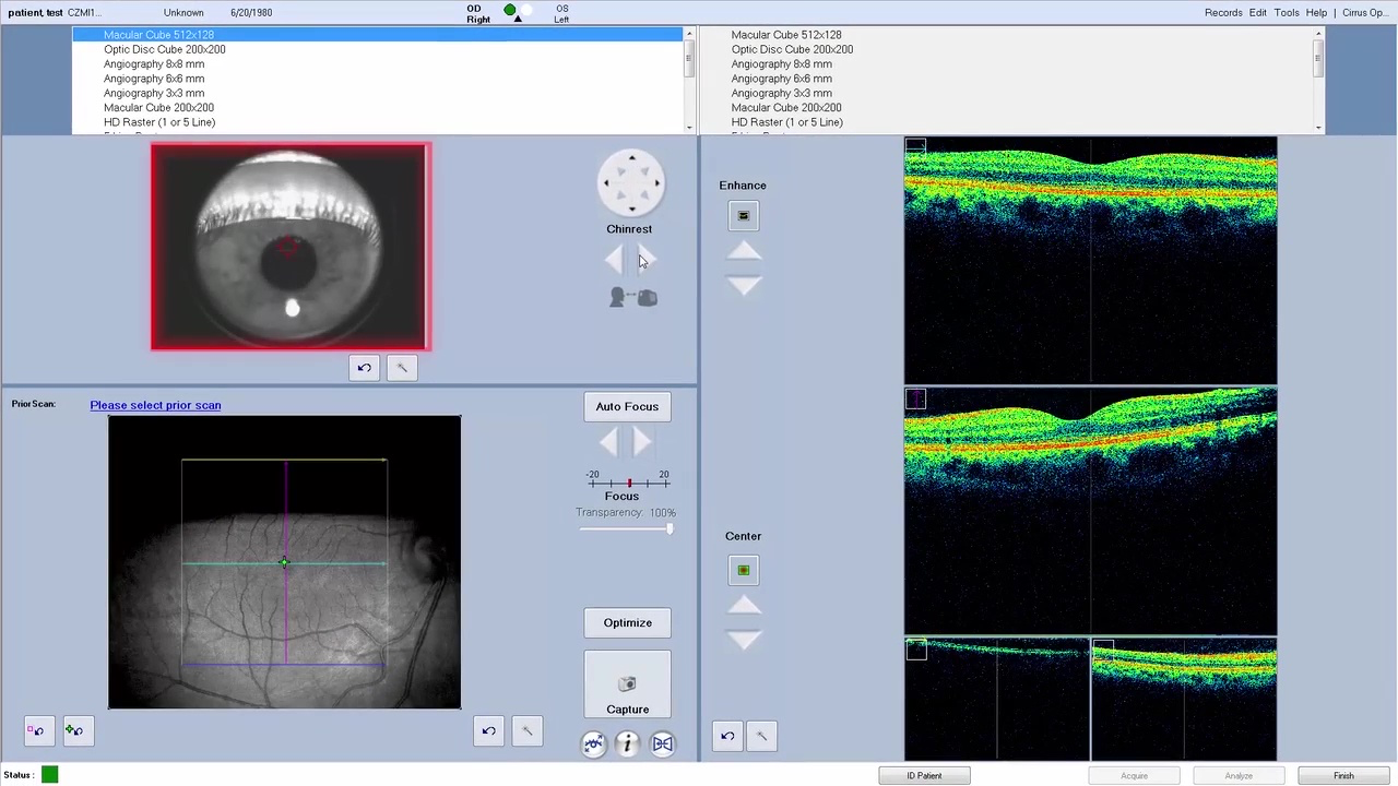 Optical Coherence Tomography