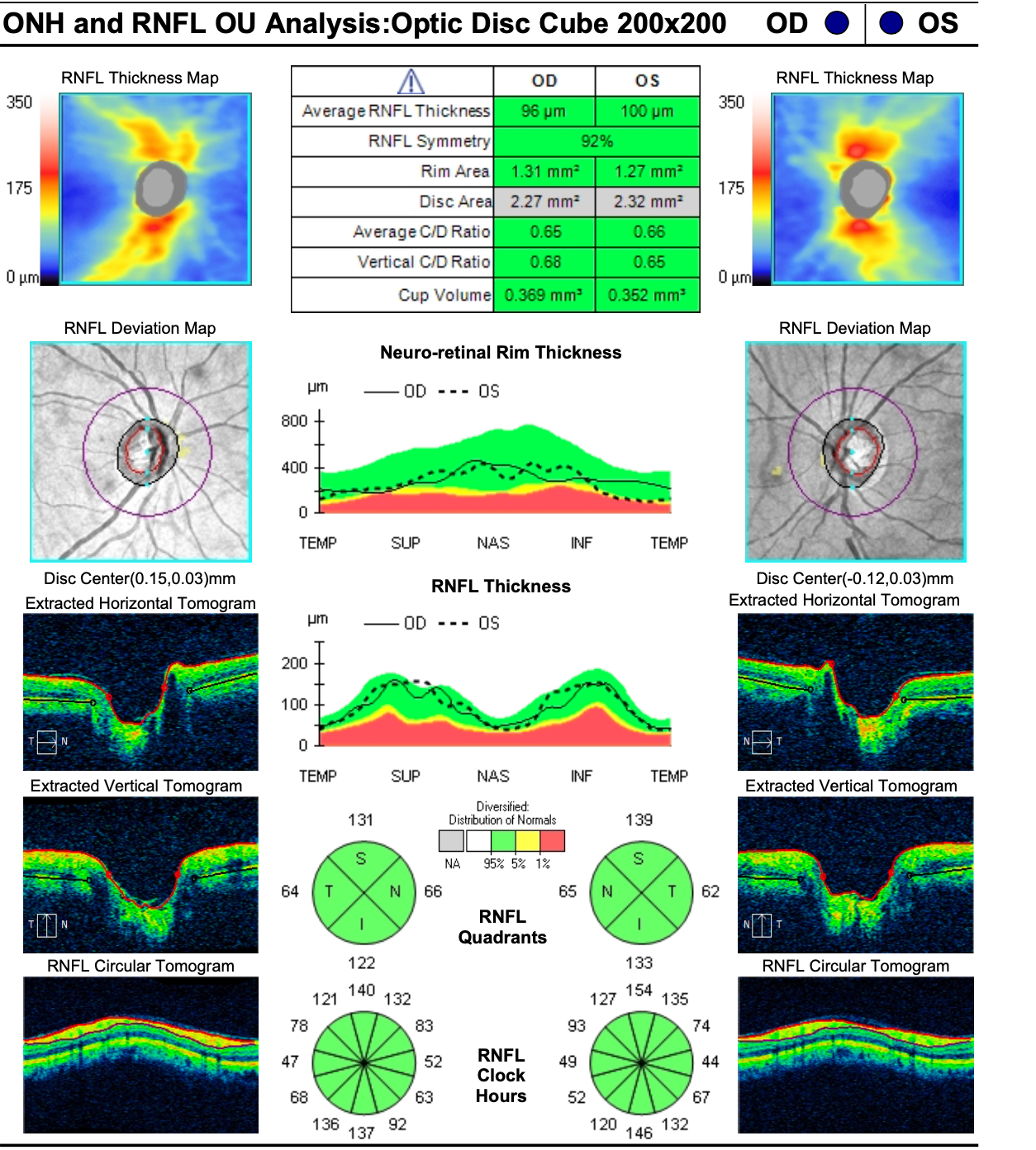 Optical Coherence Tomography