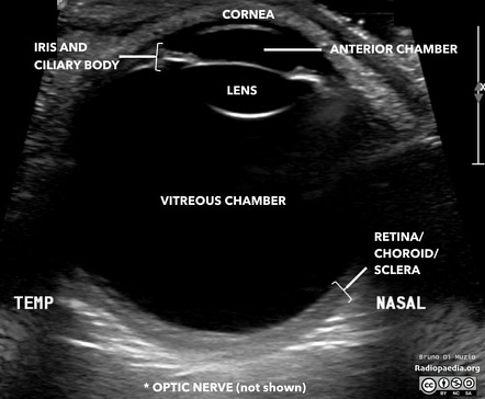 Ophthlamic Ultrasonography